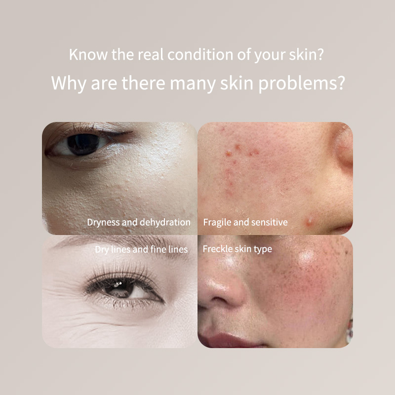 Portable Skin Tester Pen - For - Skincare Only You ulasan dan harga
