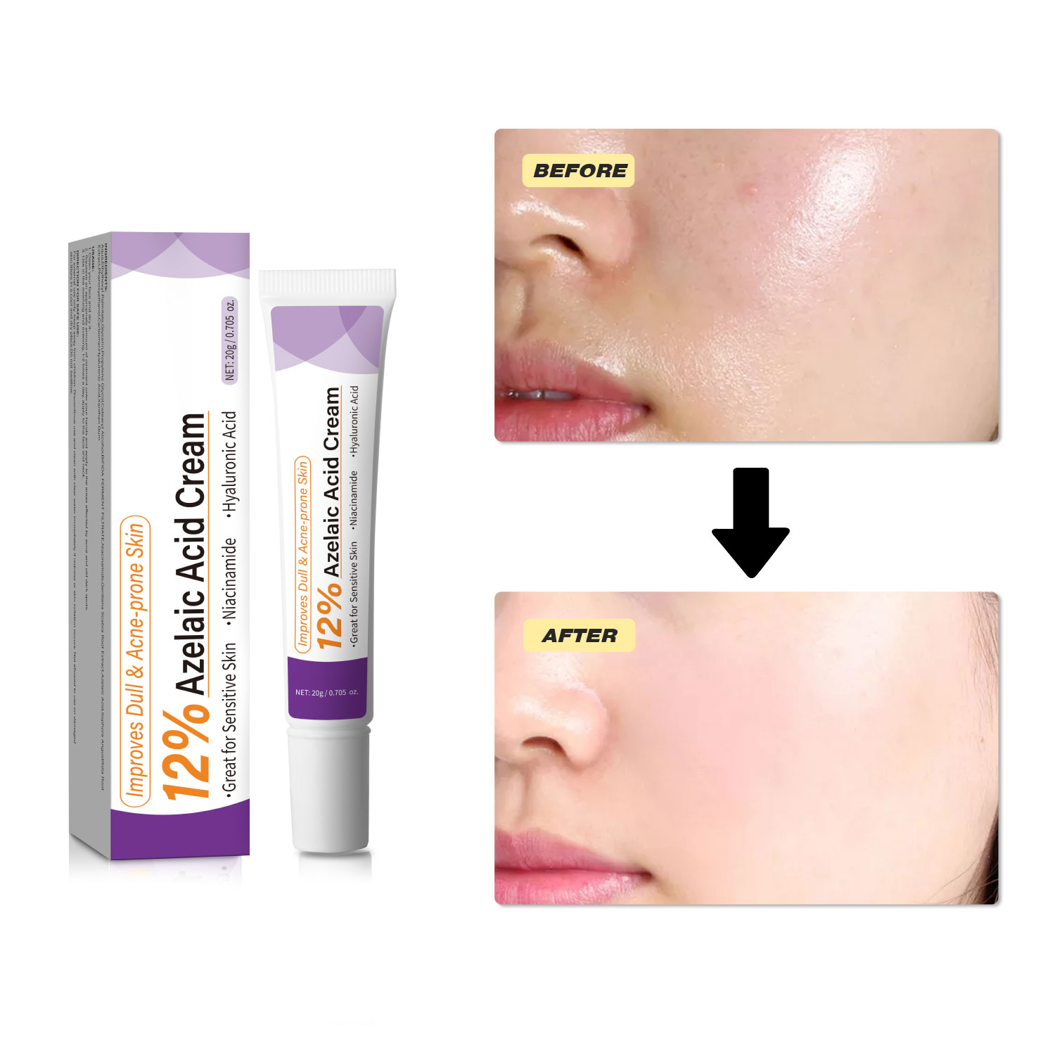 Mild Azelaic Acid Cream Improv - Skincare Skintific ulasan dan harga