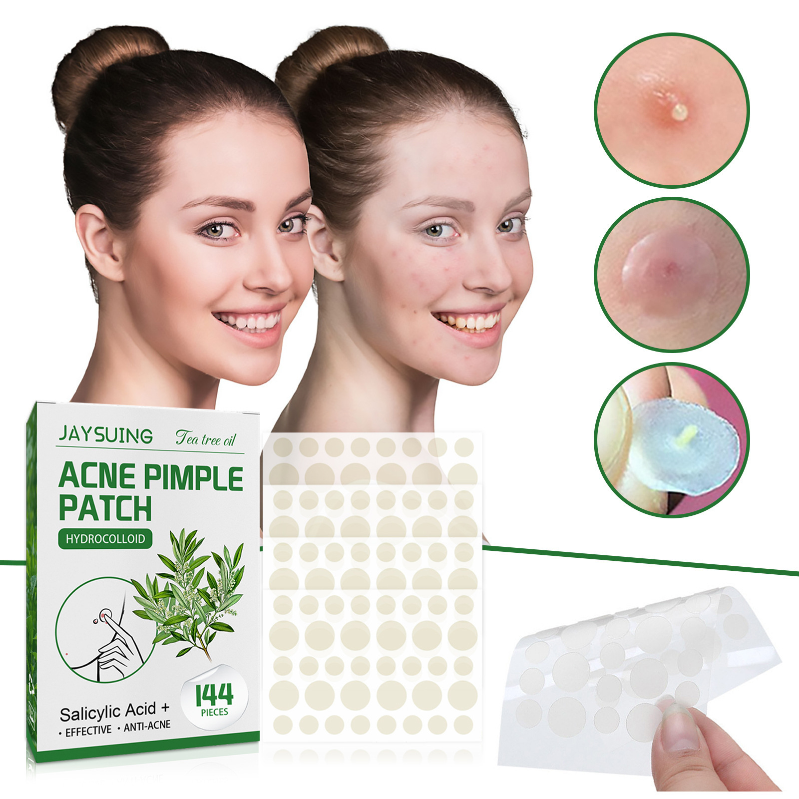 Hydrocolloid Acne Patches - Ab - Skincare Moisturizer ulasan dan harga
